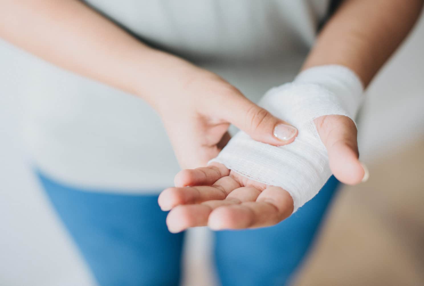 Skin Burn Awareness